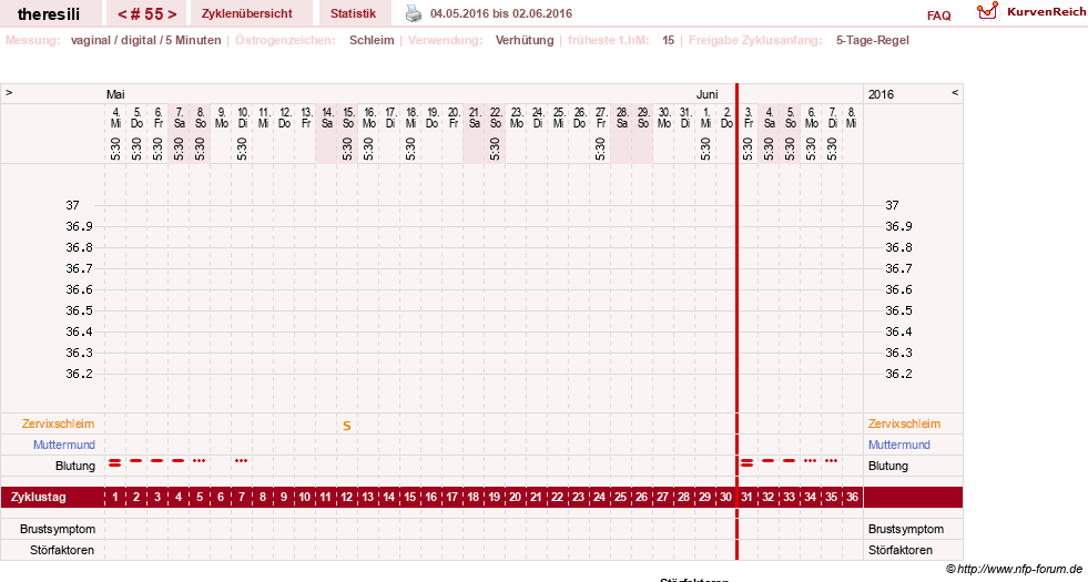 NFP-Kurve User #18189