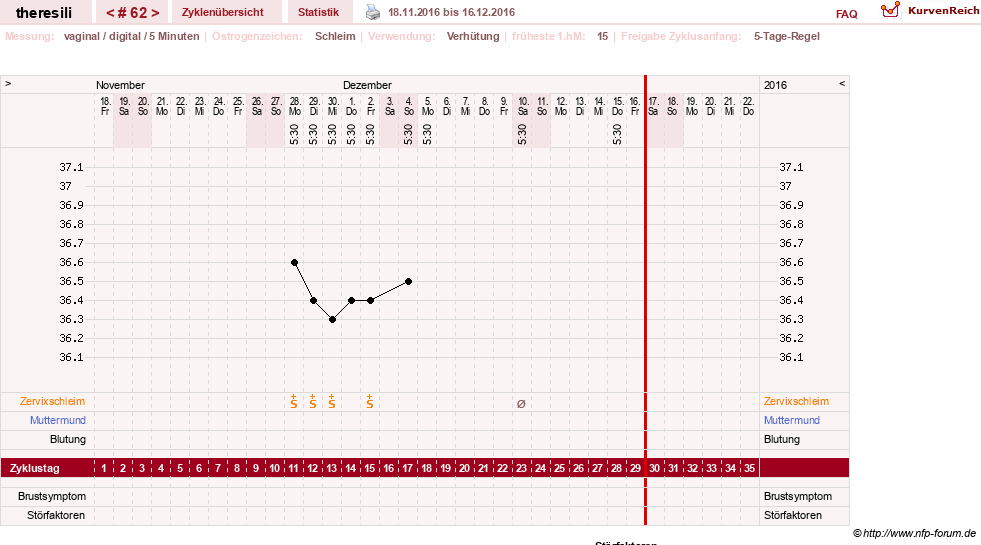 NFP-Kurve User #18189