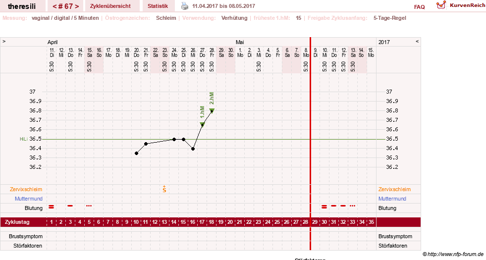 NFP-Kurve User #18189