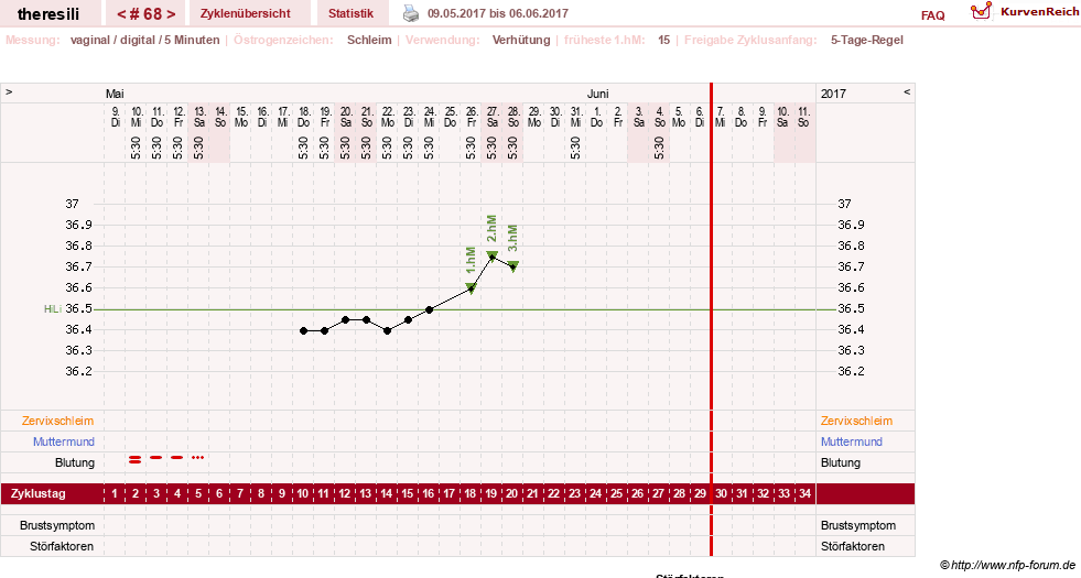 NFP-Kurve User #18189