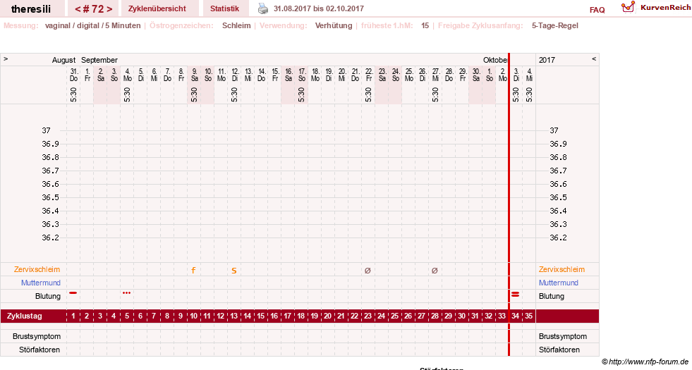 NFP-Kurve User #18189