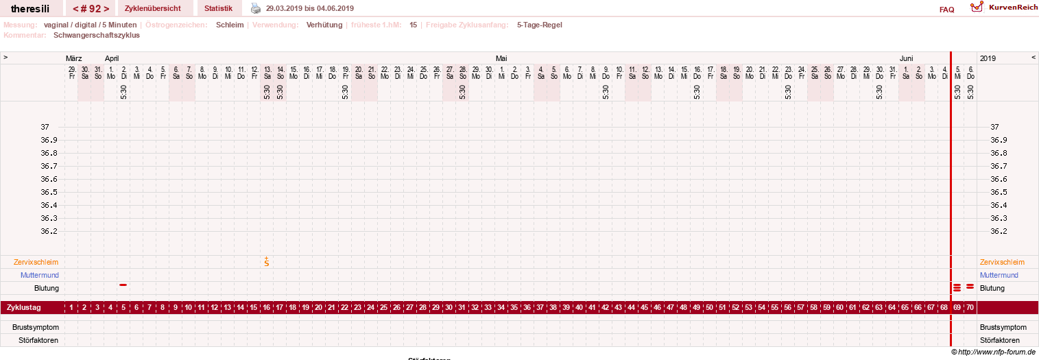 NFP-Kurve User #18189