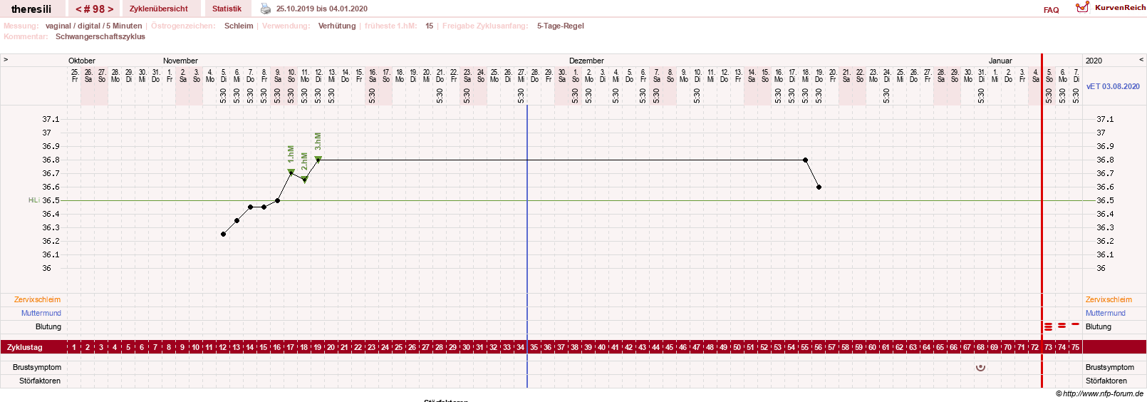NFP-Kurve User #18189