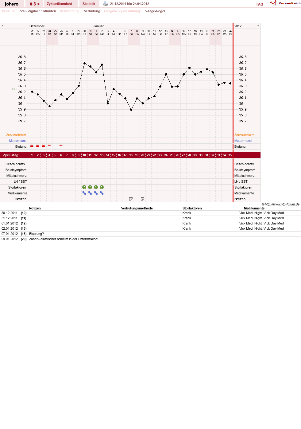 NFP-Kurve User #18308