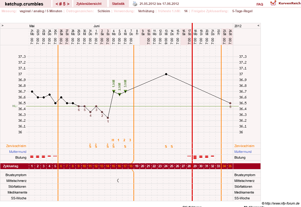 NFP-Kurve User #18730