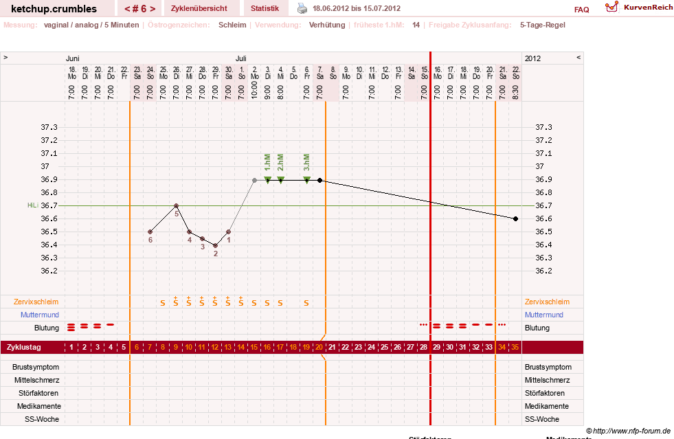 NFP-Kurve User #18730
