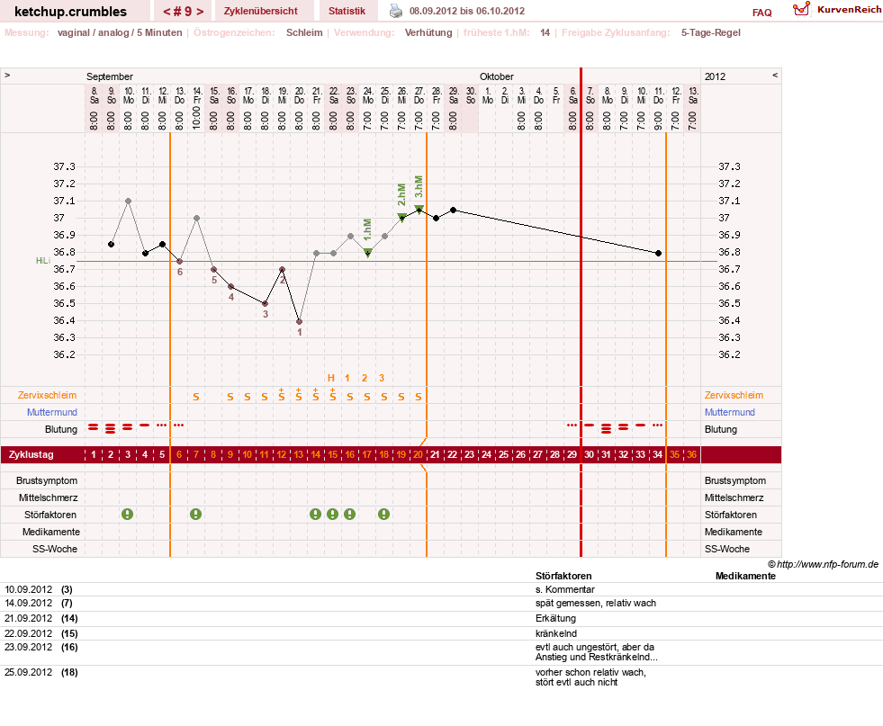 NFP-Kurve User #18730