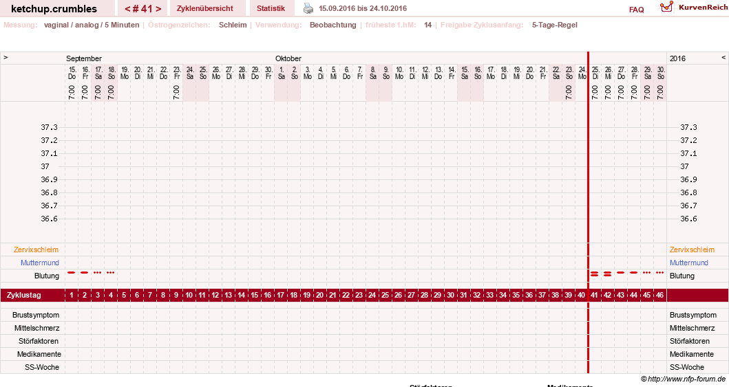NFP-Kurve User #18730