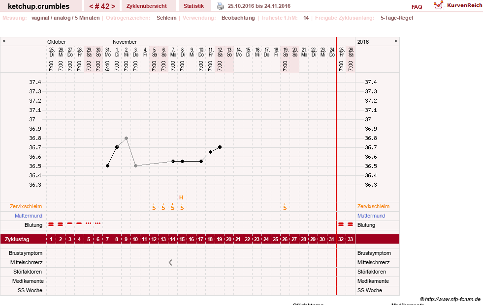 NFP-Kurve User #18730