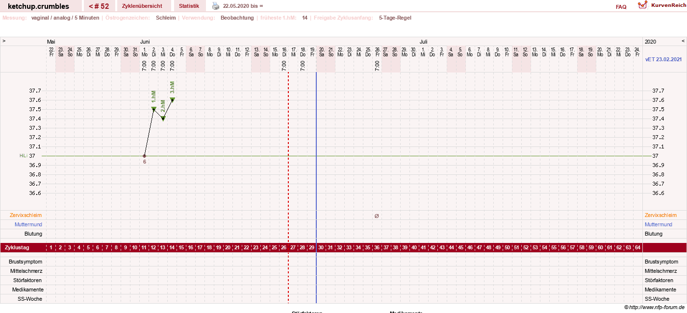 NFP-Kurve User #18730