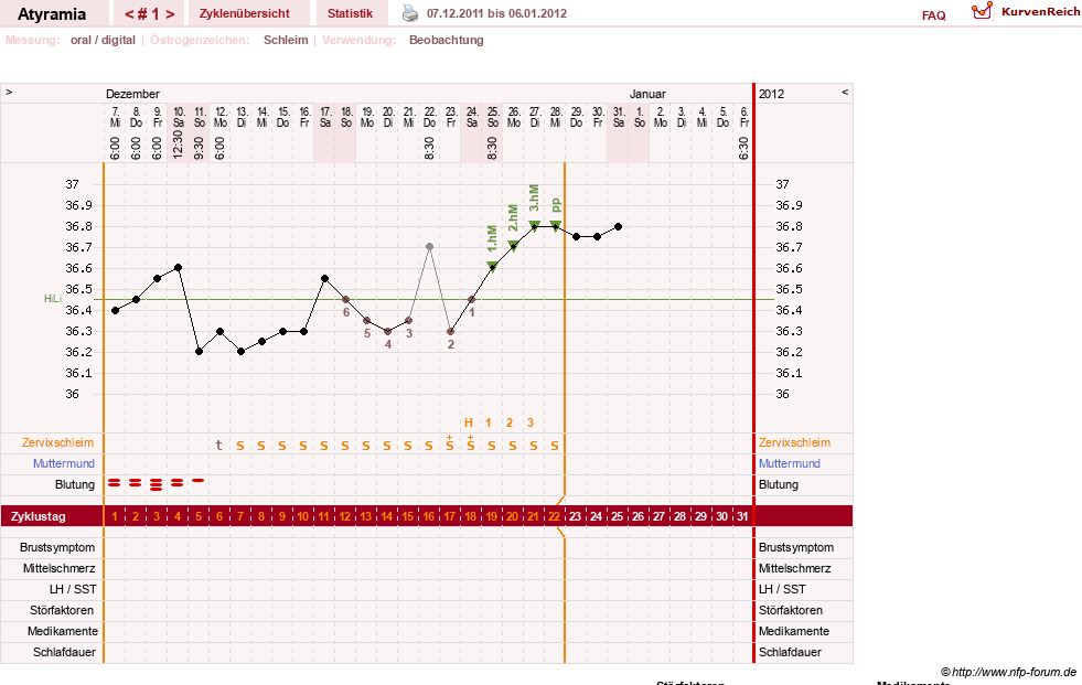 NFP-Kurve User #18796