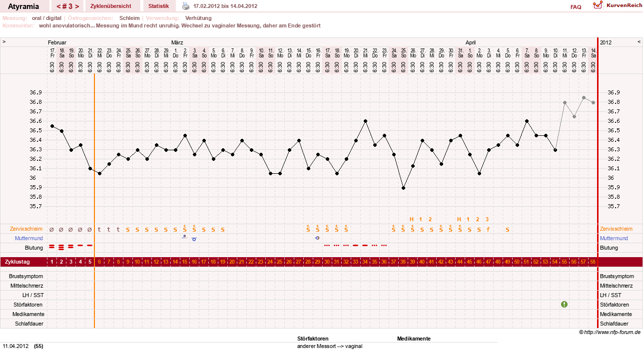 NFP-Kurve User #18796
