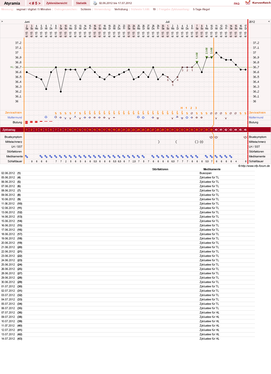 NFP-Kurve User #18796