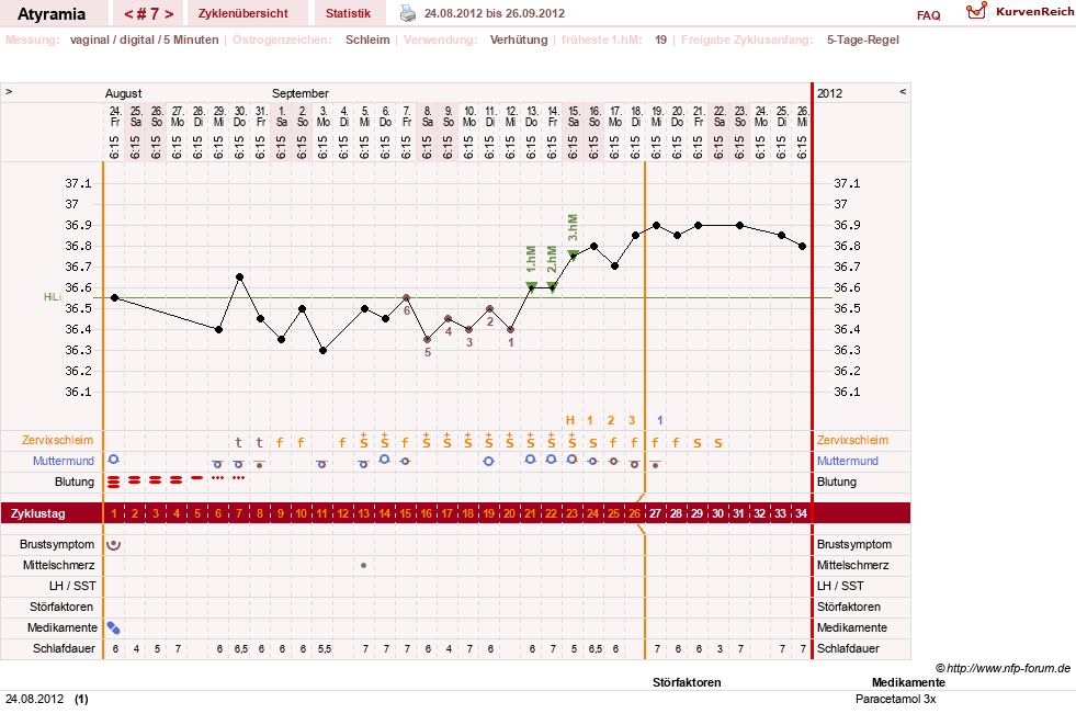 NFP-Kurve User #18796