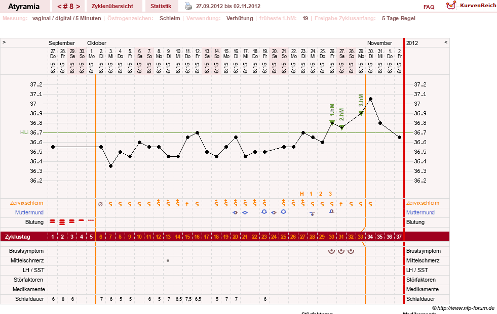 NFP-Kurve User #18796