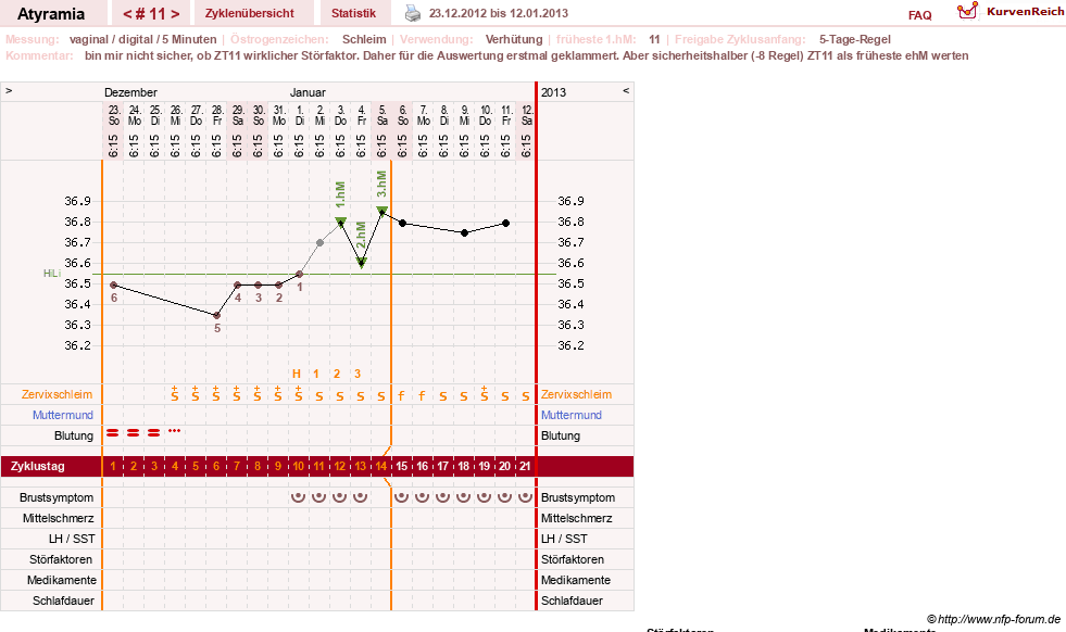 NFP-Kurve User #18796