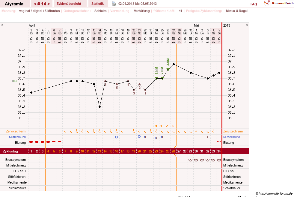 NFP-Kurve User #18796