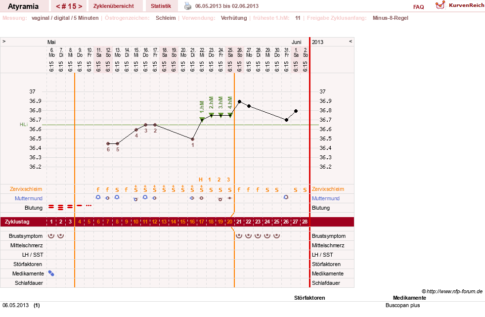 NFP-Kurve User #18796