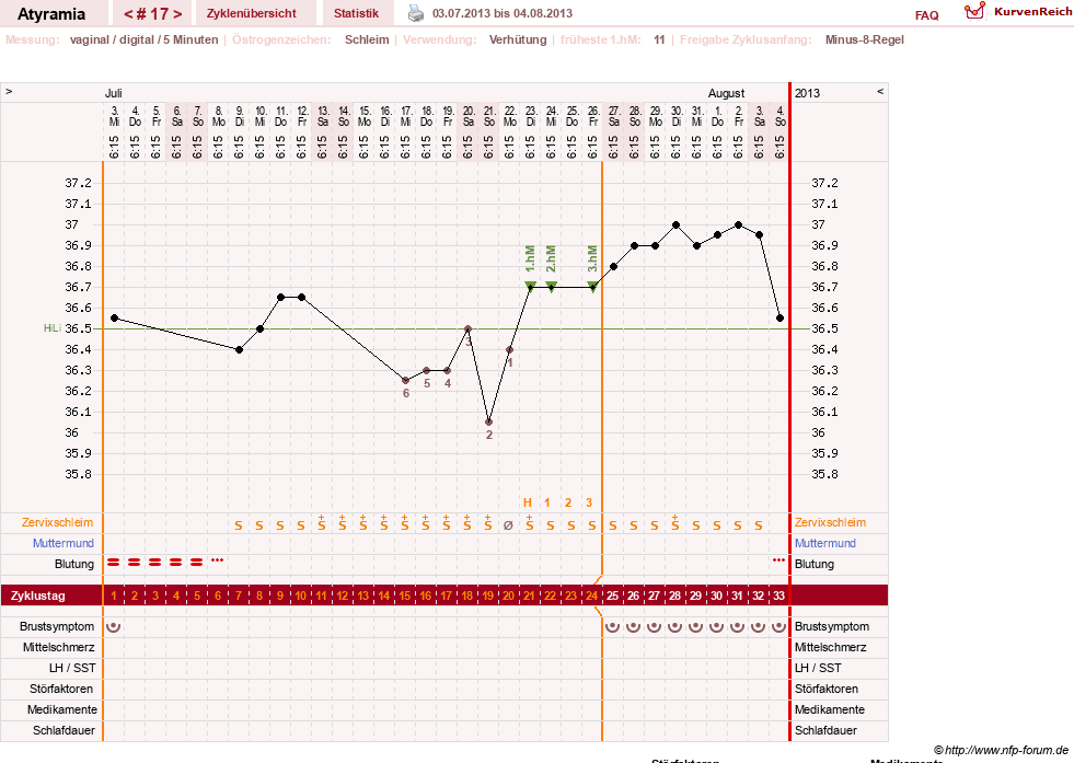 NFP-Kurve User #18796