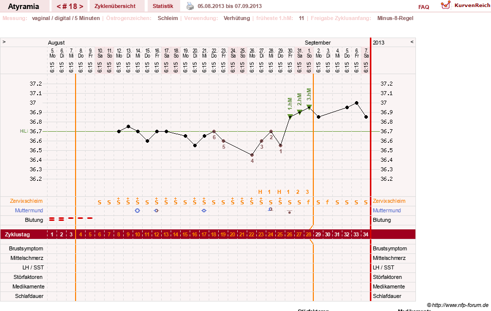 NFP-Kurve User #18796