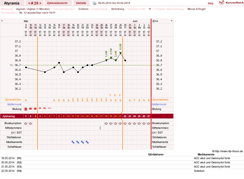 NFP-Kurve User #18796