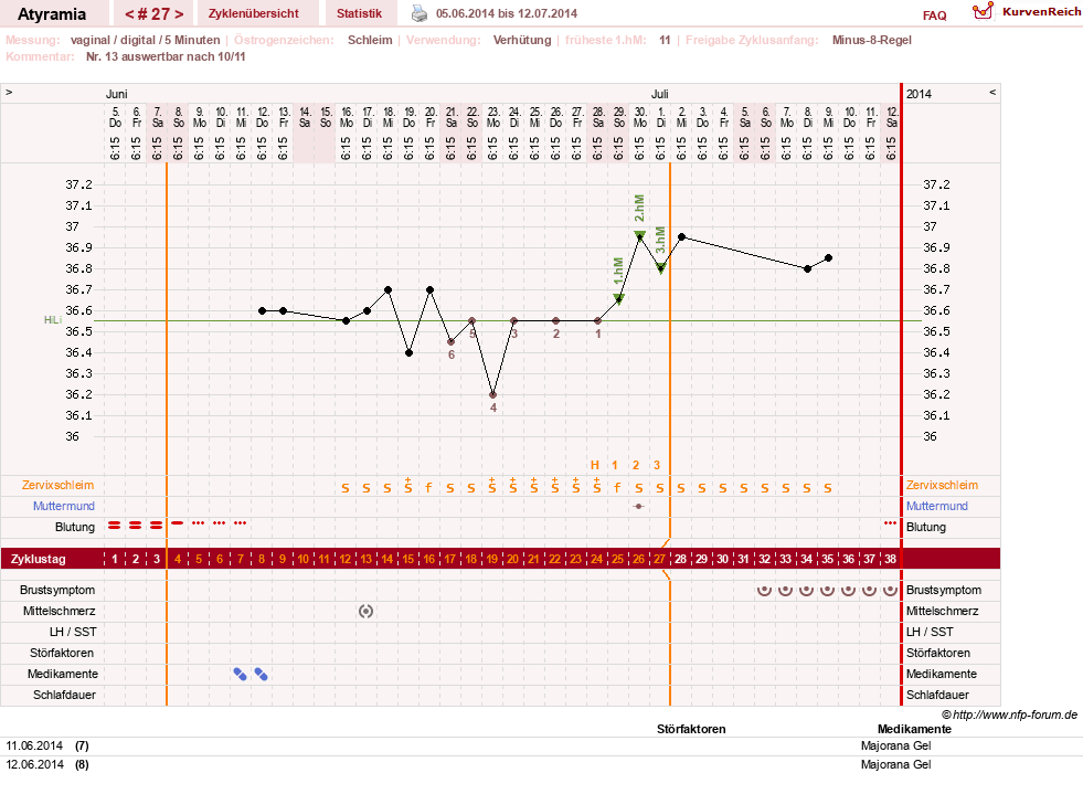 NFP-Kurve User #18796