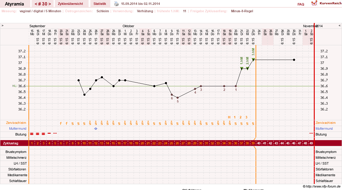 NFP-Kurve User #18796