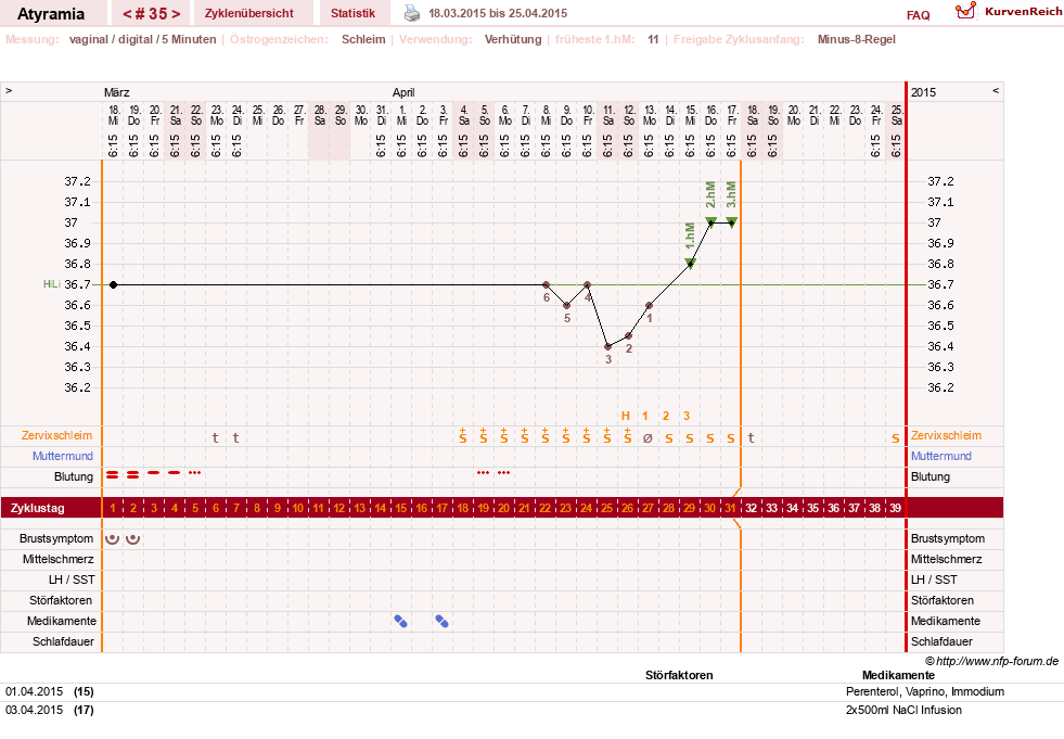 NFP-Kurve User #18796