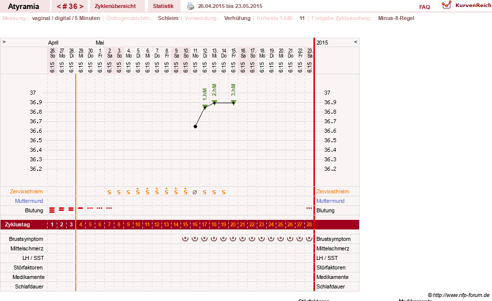 NFP-Kurve User #18796