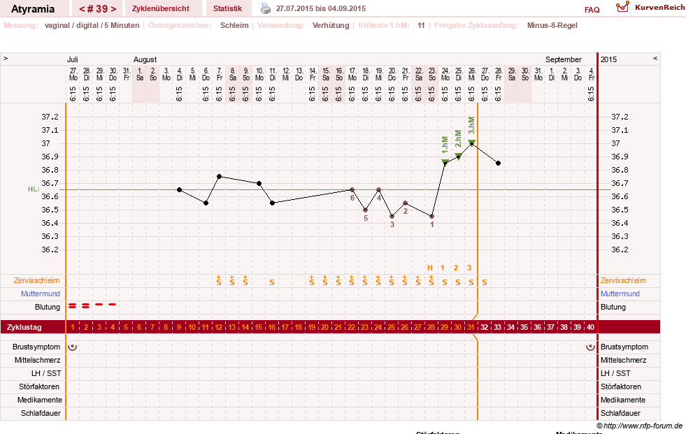 NFP-Kurve User #18796