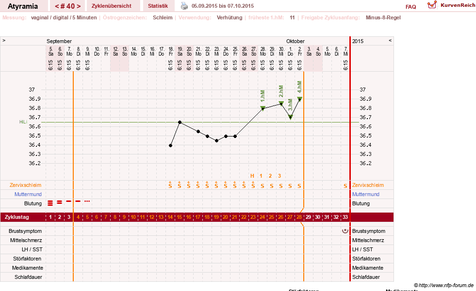 NFP-Kurve User #18796