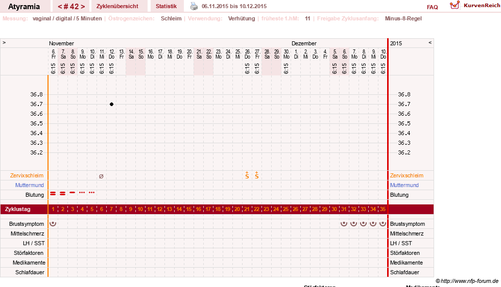 NFP-Kurve User #18796