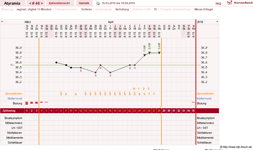 NFP-Kurve User #18796