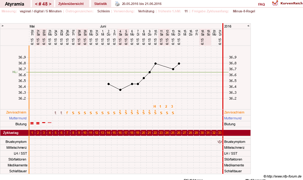 NFP-Kurve User #18796