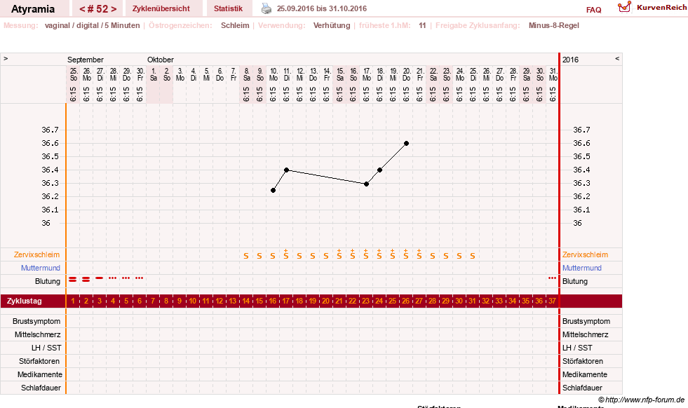 NFP-Kurve User #18796