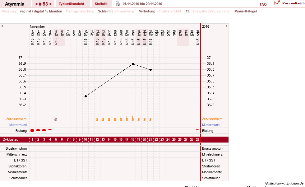 NFP-Kurve User #18796