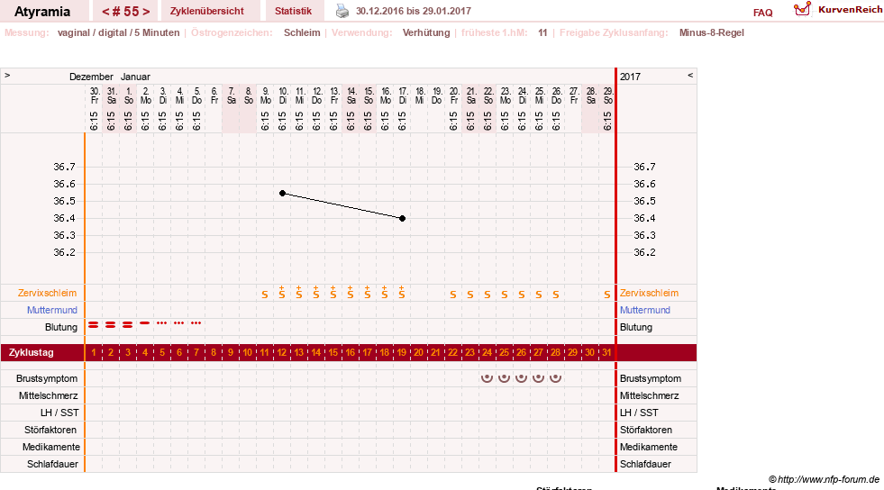 NFP-Kurve User #18796