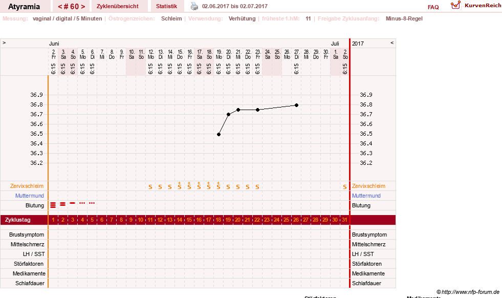 NFP-Kurve User #18796