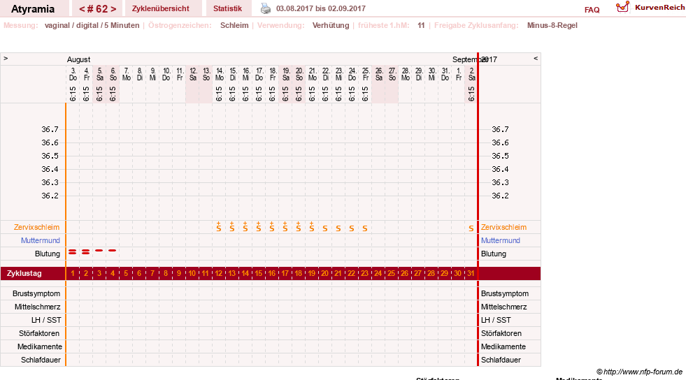 NFP-Kurve User #18796