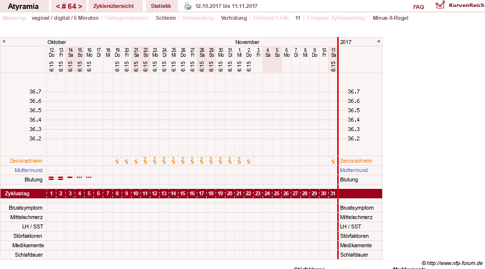 NFP-Kurve User #18796