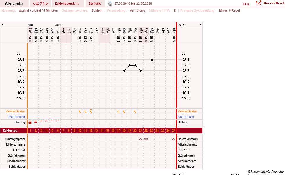 NFP-Kurve User #18796