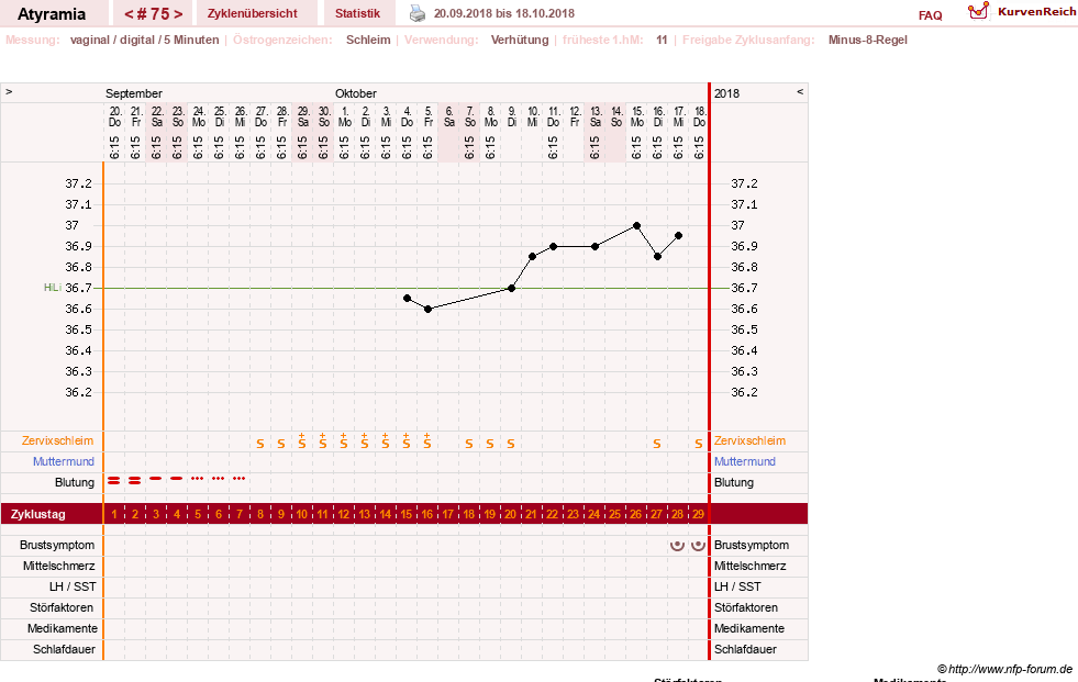 NFP-Kurve User #18796