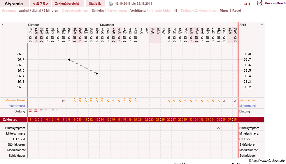 NFP-Kurve User #18796