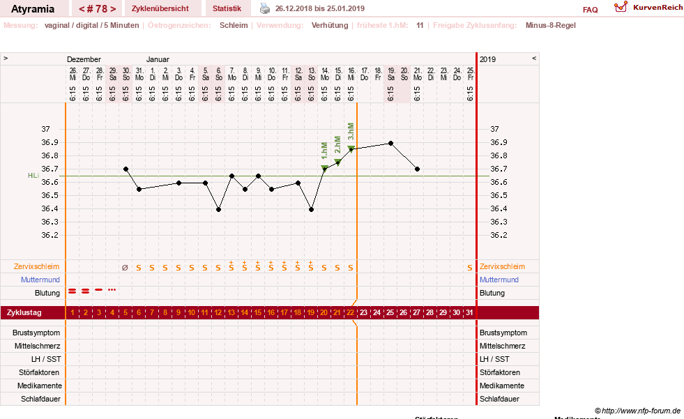 NFP-Kurve User #18796