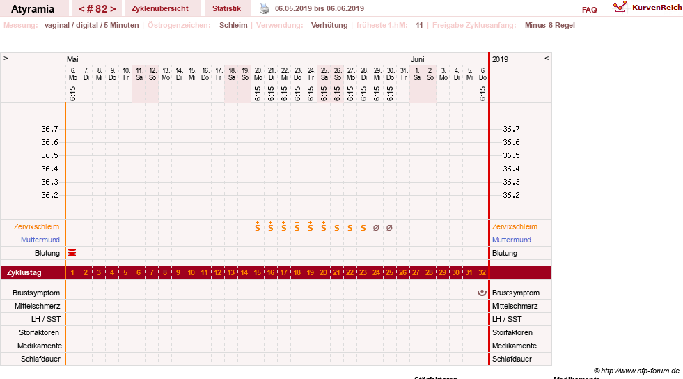 NFP-Kurve User #18796
