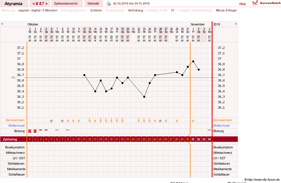 NFP-Kurve User #18796