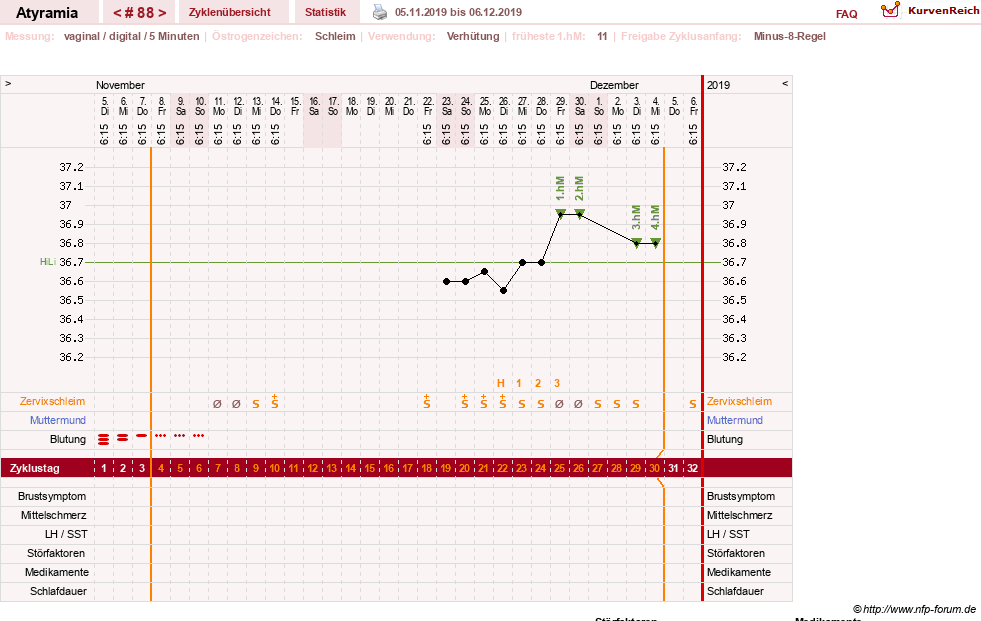 NFP-Kurve User #18796