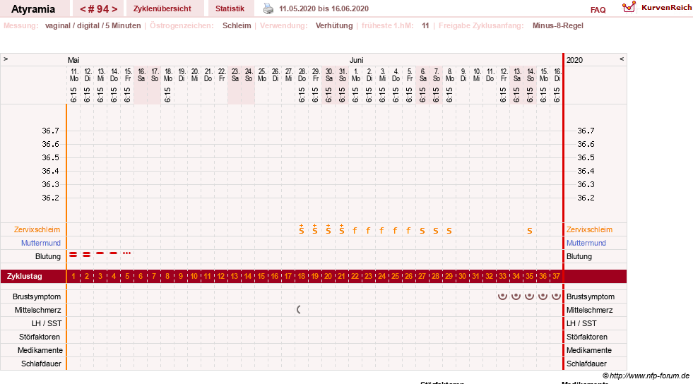 NFP-Kurve User #18796