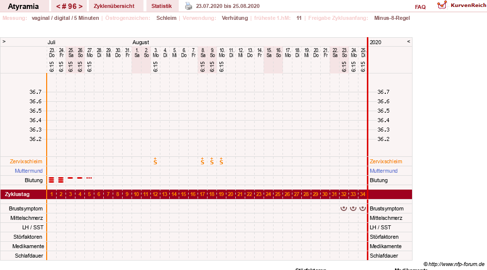 NFP-Kurve User #18796