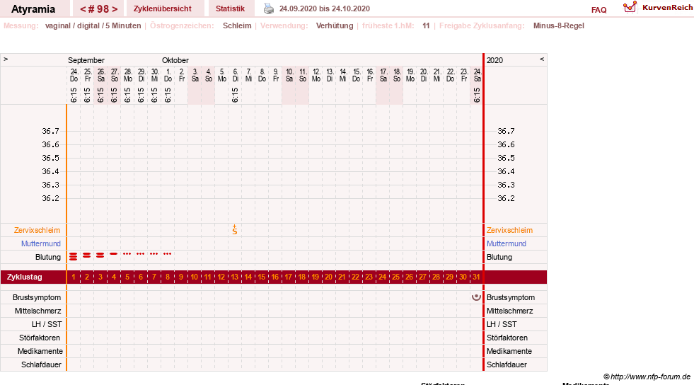 NFP-Kurve User #18796